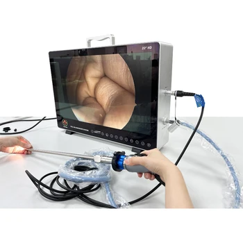 SY-PS050 Prenosné endoskopická Pre Humánne A Veterinárne Full Hd 1080p Integrovaná Správa/laparoskopia/urológia Lekárske Endoskopia